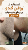 پک درمانی کبد کلیه سردرد از نوع سردرد درمان استرس و اضطراب