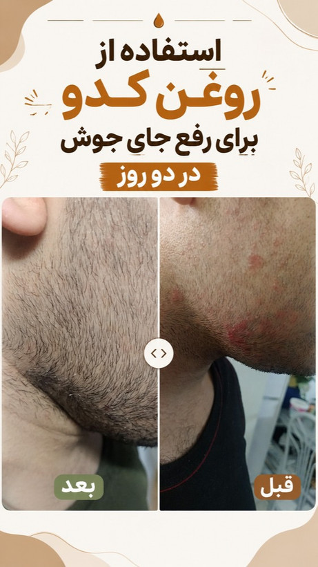 پک درمانی کبد کلیه سردرد از نوع سردرد درمان استرس و اضطراب