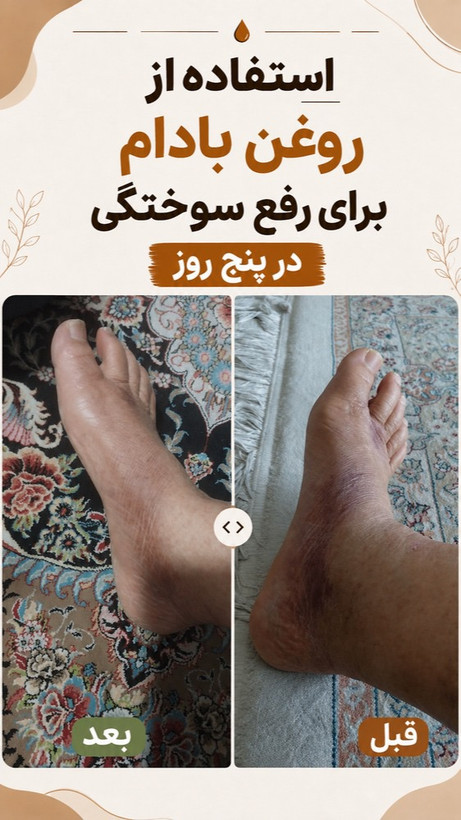 پک درمانی کبد کلیه سردرد از نوع سردرد درمان استرس و اضطراب