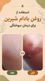 پک درمانی کبد کلیه سردرد از نوع سردرد درمان استرس و اضطراب