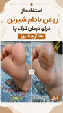 پک درمانی کبد کلیه سردرد از نوع سردرد درمان استرس و اضطراب