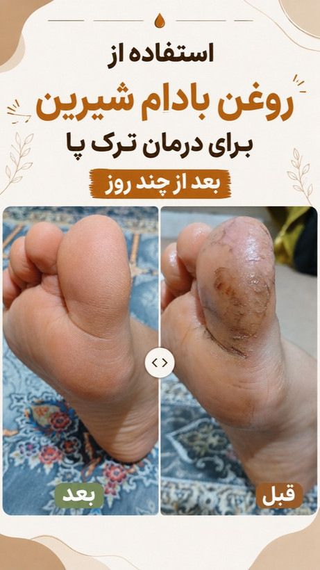 پک درمانی کبد کلیه سردرد از نوع سردرد درمان استرس و اضطراب