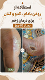 پک درمانی کبد کلیه سردرد از نوع سردرد درمان استرس و اضطراب